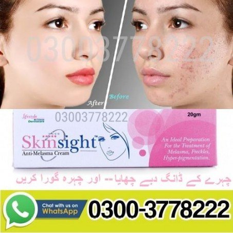 Skinsight Anti Melasma Cream