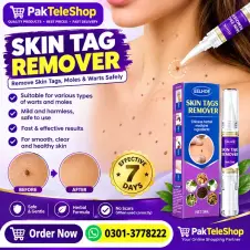 Skin Tag Warts Mole Remover Pen in Pakistan